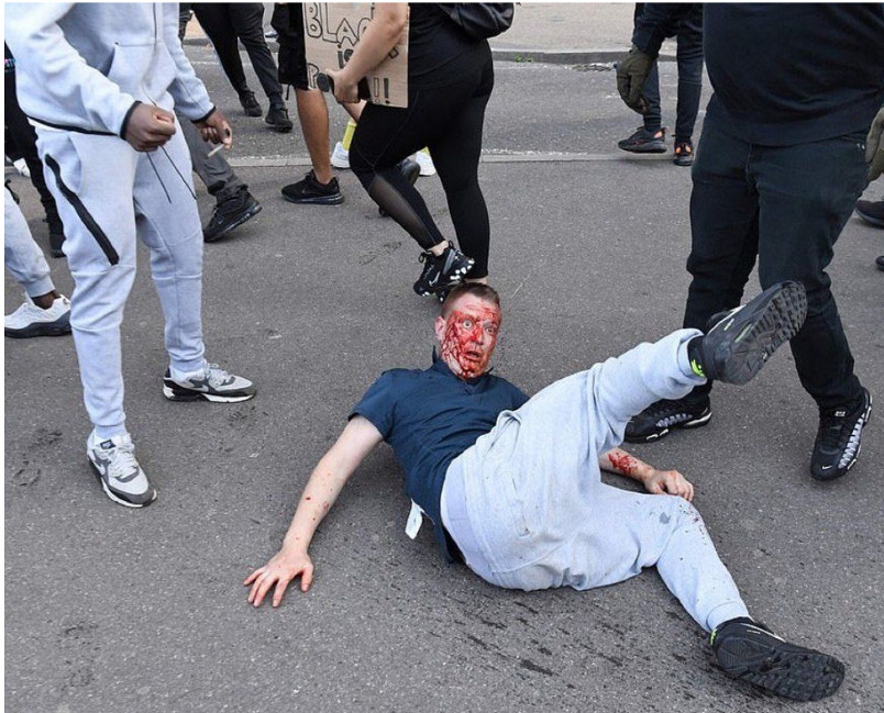 only-black-lives.jpeg