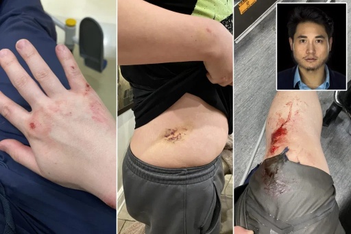 antifa-terroristit pahoinpitelivät taas aasialaistaustaisen toimittajan Andy NGOn.jpg