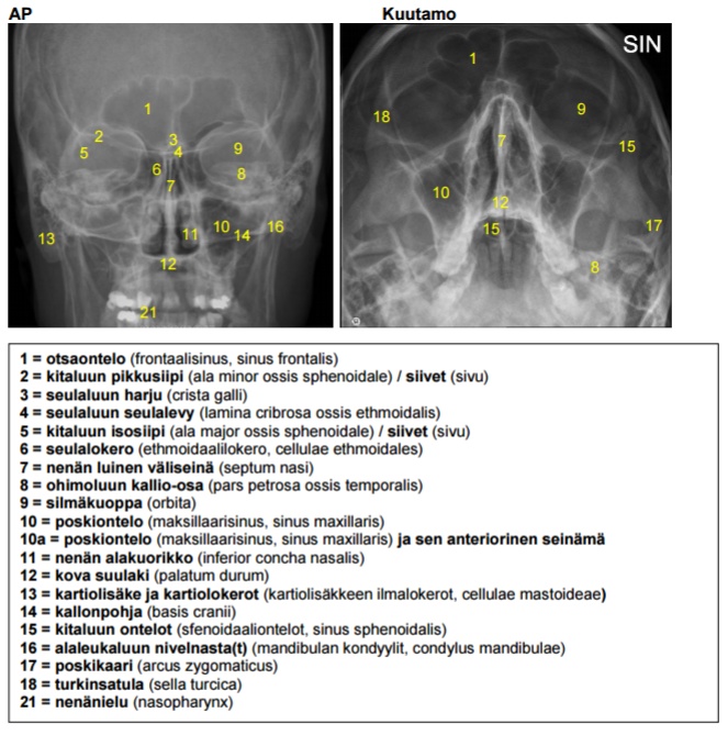 Kasvonluiden anatomia, natiiviRtg1.jpg