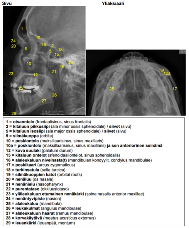 Kasvonluiden anatomia, natiiviRtg2.jpg