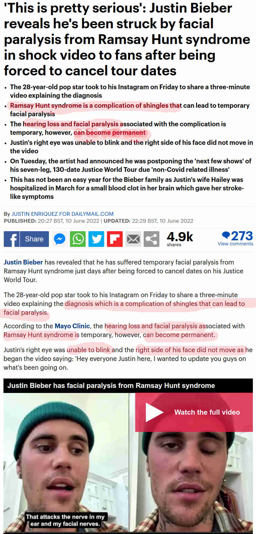 Justin ja vyöruusun komplikaation aiheuttama kasvohalvaus sekä kuulon alenema.jpg
