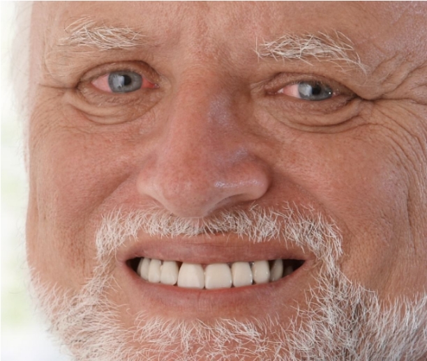 hide the pain harold.jpg