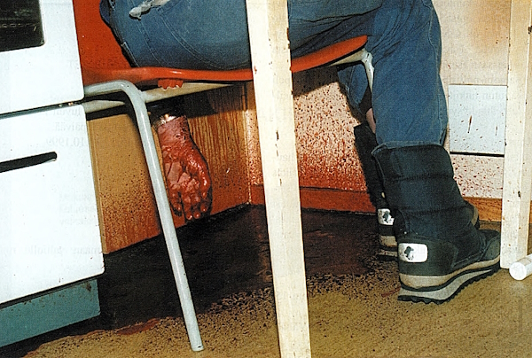 Uhrin tuolin alla ja seinässä oli runsaasti verta.jpg