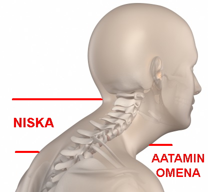 niska.jpg