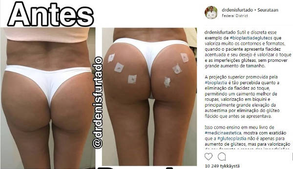 https://www.instagram.com/drdenisfurtado/