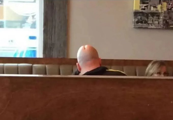 pälvikaljukimaltaa.jpg