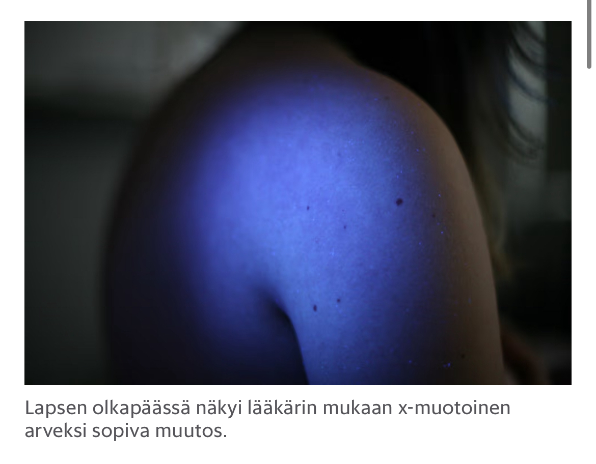 olkapaa.jpeg