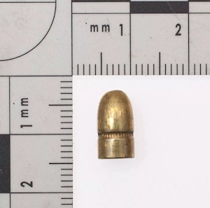 Kuva leikkauksella uhrista poistetusta luodista.jpg