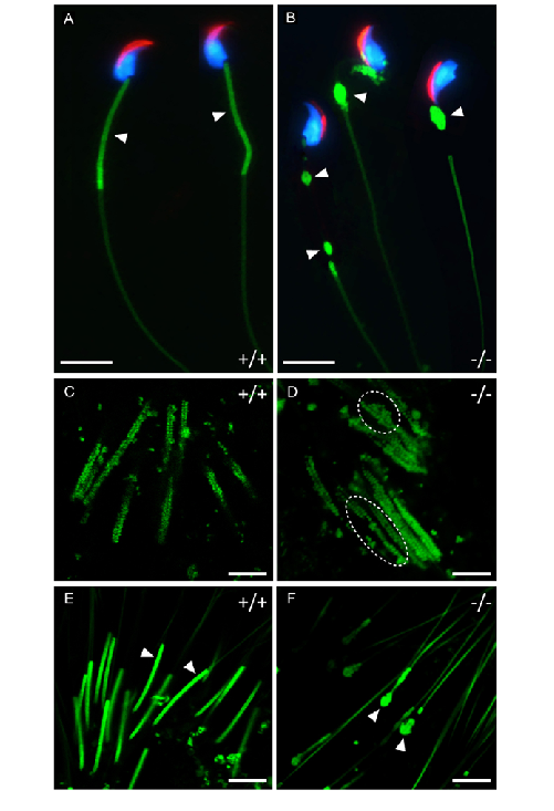 Morphogenesis-of-the-mitochondrial-sheath-A-BStaining-of-cauda-epididymal-sperm-with.png